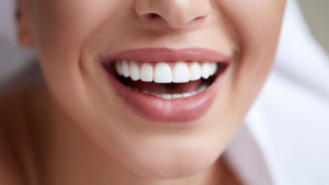 Una bocca con denti sani e brillanti, risultato di una buona igiene orale e abitudini alimentari sane."